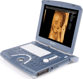 GE Voluson I 3D/4D Laptop