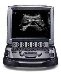 Ultrasound equipment for elective pregnancy imaging