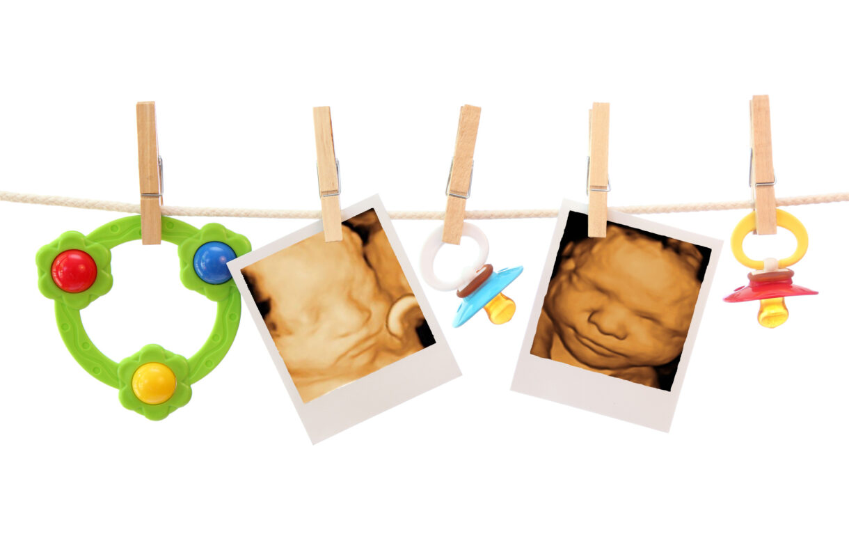 Equipment needed for a 4D ultrasound franchise