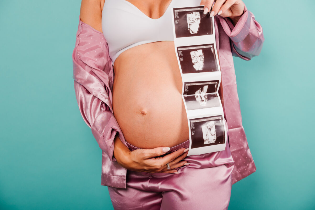 Elective ultrasound training for prenatal imaging