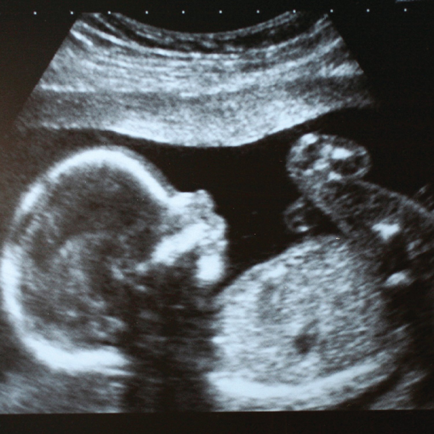 Online elective ultrasound training with certification