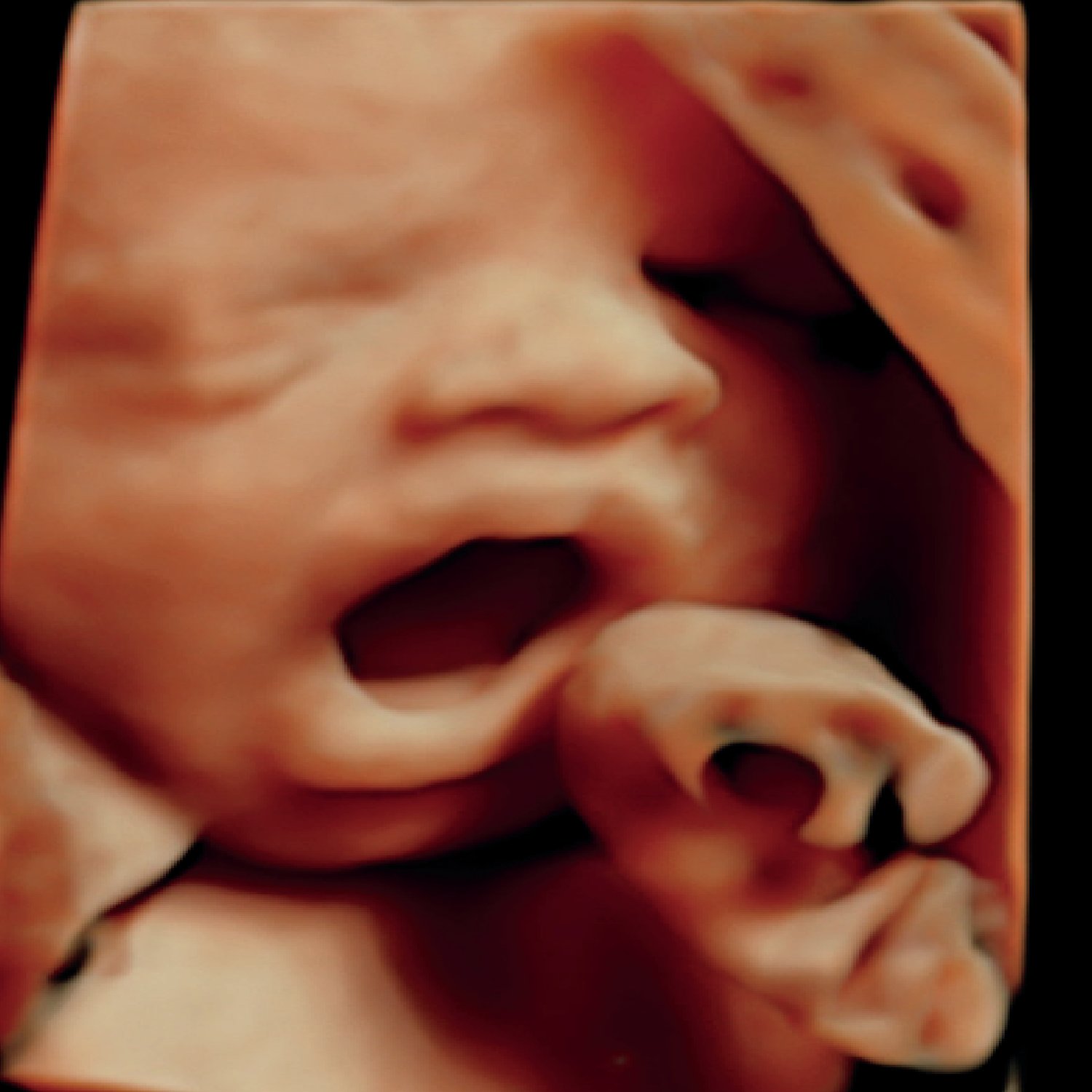 How to become a certified elective ultrasound technician