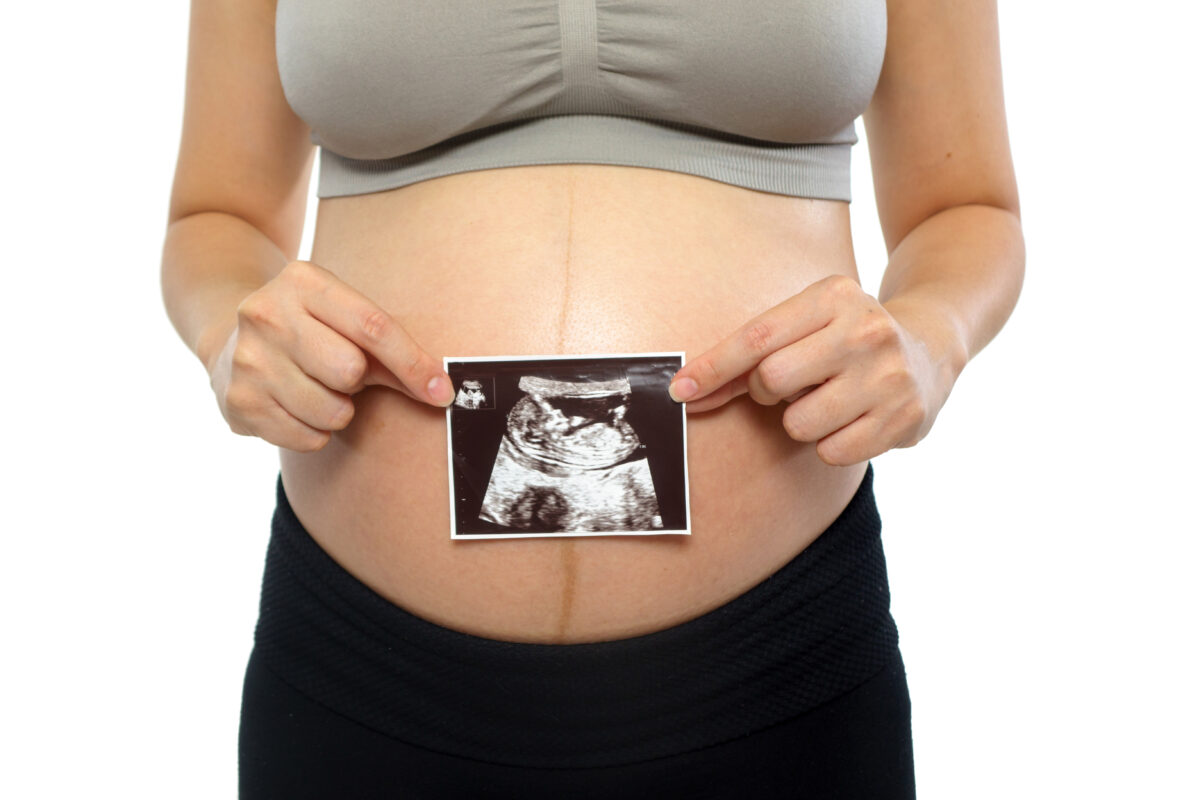 Non-medical elective ultrasound training schools