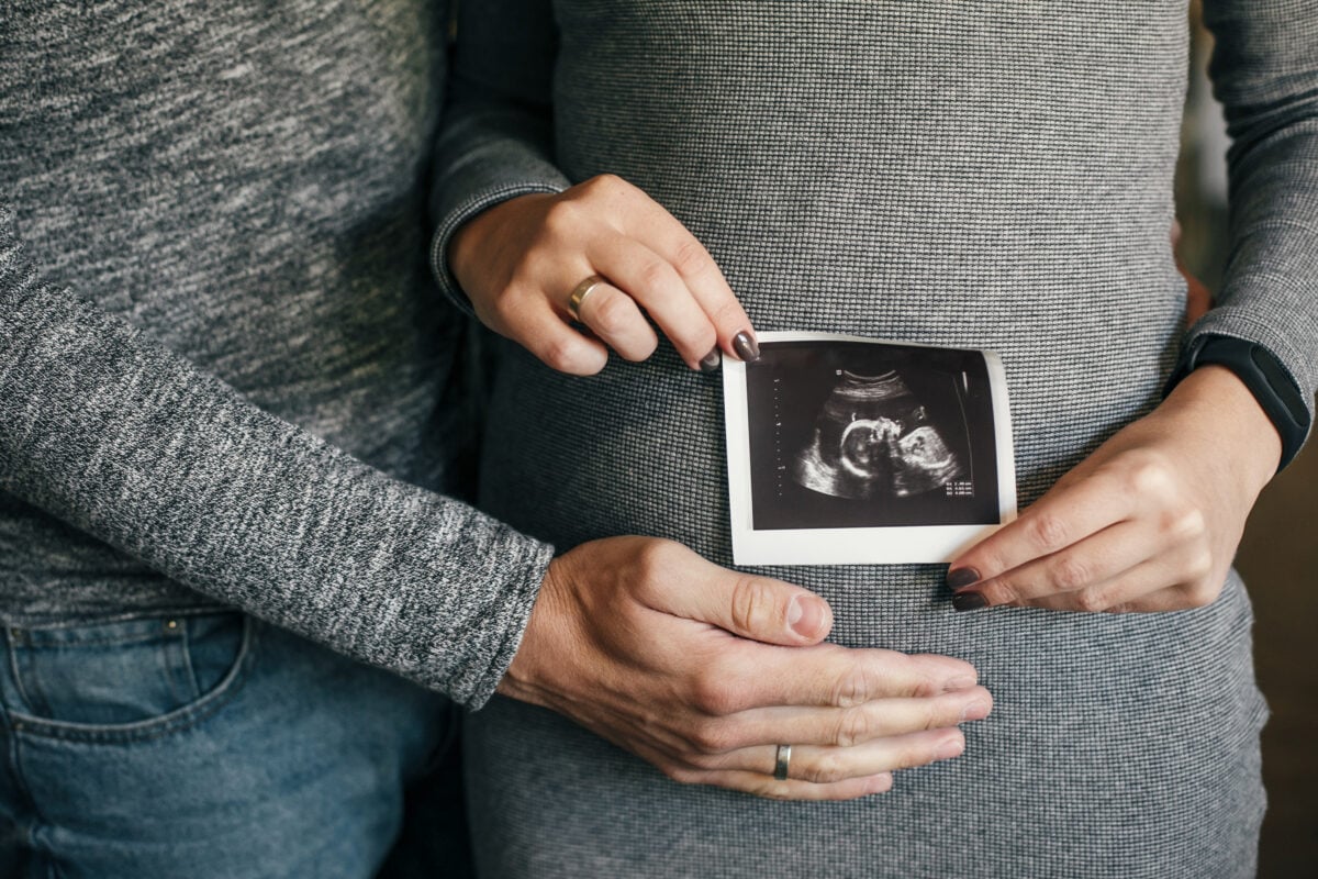Stylish pregnant couple holding ultrasound scan of baby on baby