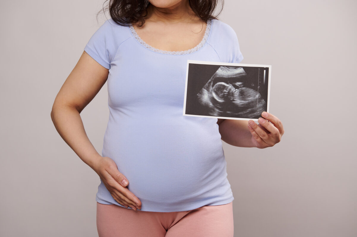3D/4D ultrasound training with no experience