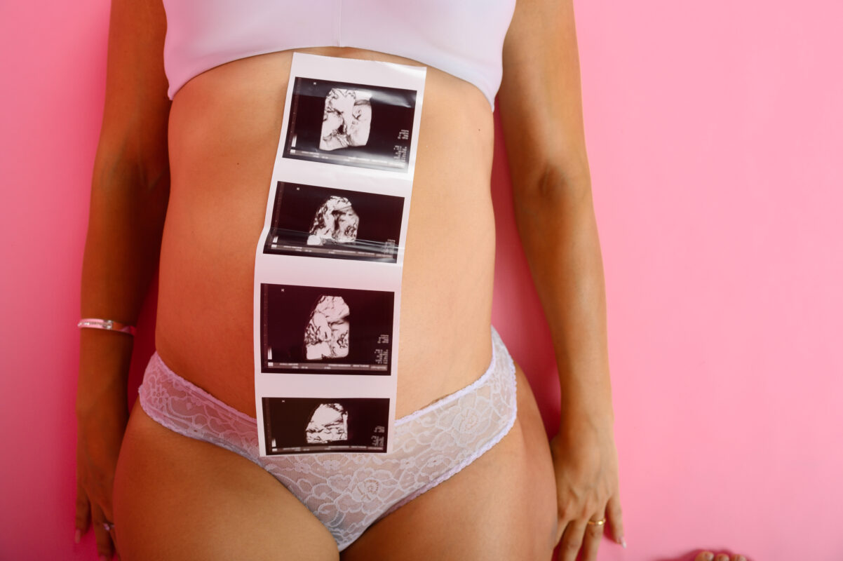 Top-rated elective ultrasound studios near me