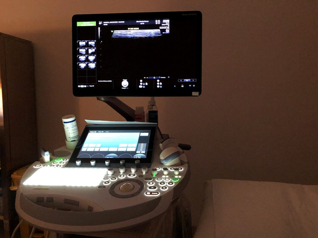 elective 4d ultrasound equipment
