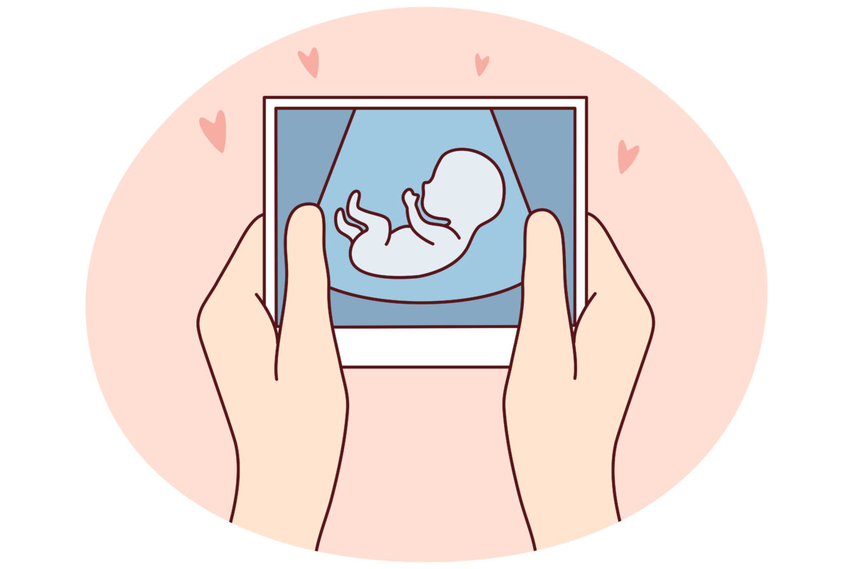 What You Need to Know About 3D/4D Ultrasound Training and Certification