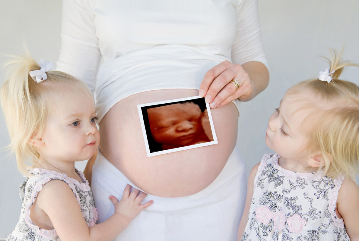 HDLive ultrasound training empowers non‑sonographers to capture stunning 3D/4D images, launch profitable keepsake studios, and elevate elective ultrasound businesses.