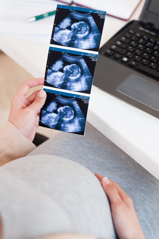 Uncover expert guidance on elective ultrasound training, startup costs, and marketing tips to build a profitable 3D/4D keepsake studio with Ultrasound Trainers—grow today.