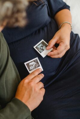 GE 5D ultrasound machine angled for optimal fetal view