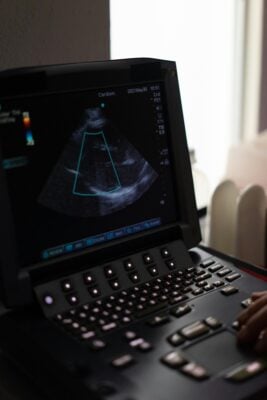 GE 5D ultrasound machine angled for optimal fetal view
