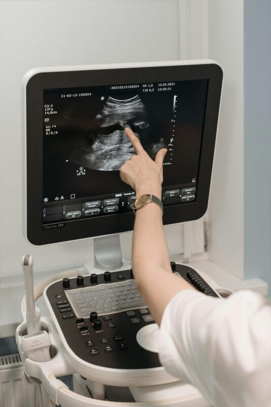 Zoomed view of Samsung HD ultrasound image quality