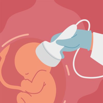 Elective Ultrasound Training