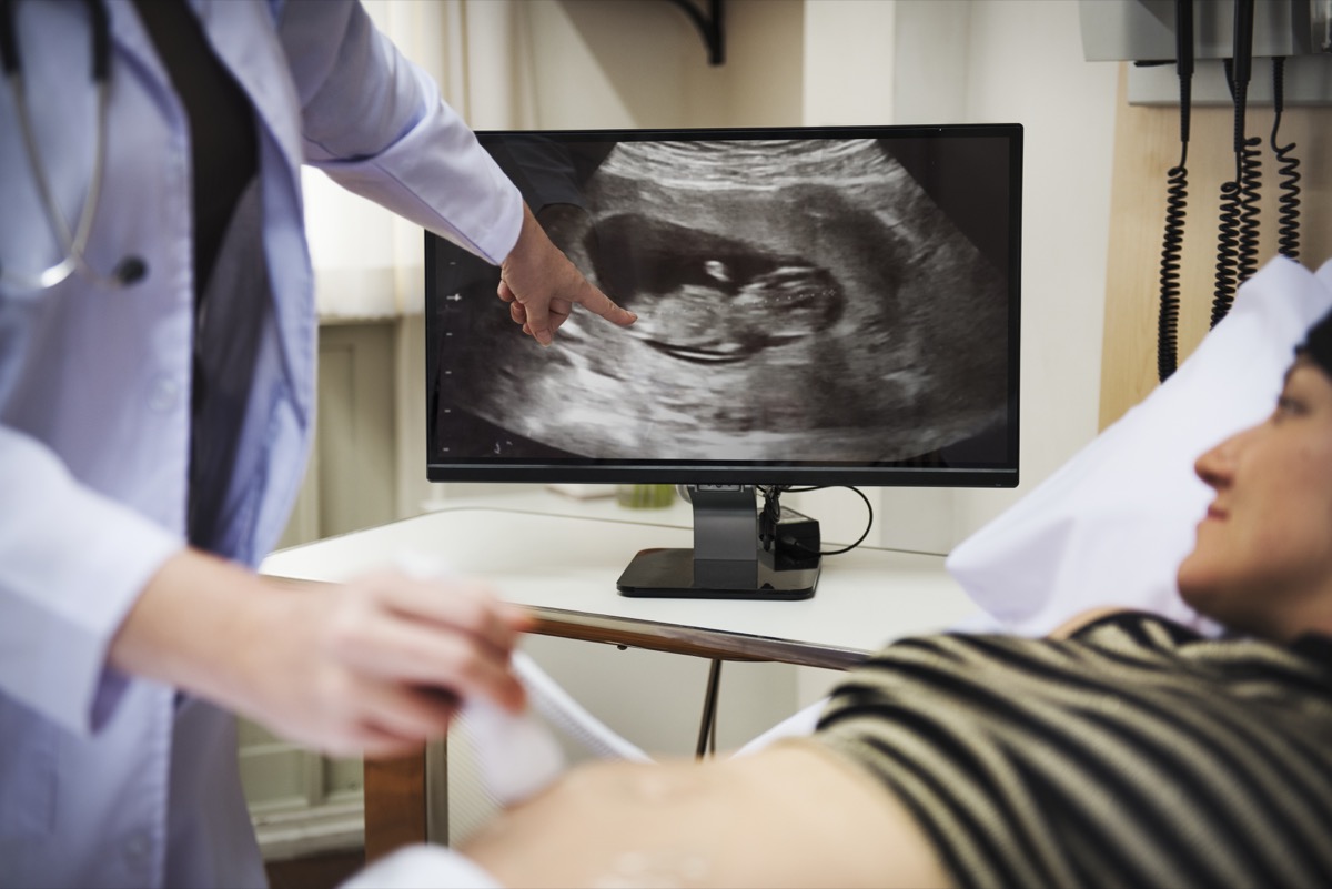 Classroom of learners around Samsung HD ultrasound unit